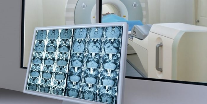 درمان بیماران سرطانی با روش‌های نوین هسته‌ای برای نخستین‌بار در کشور