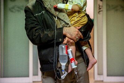 بروز موارد «روتاویروس» به حد «هشدار» نرسیده است