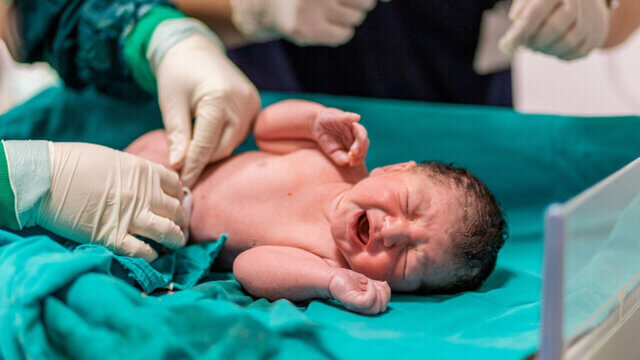 آمار ۶۰ درصدی «سزارین» در ایران؛ چرا مادران کمتر زایمان طبیعی را انتخاب می‌کنند؟